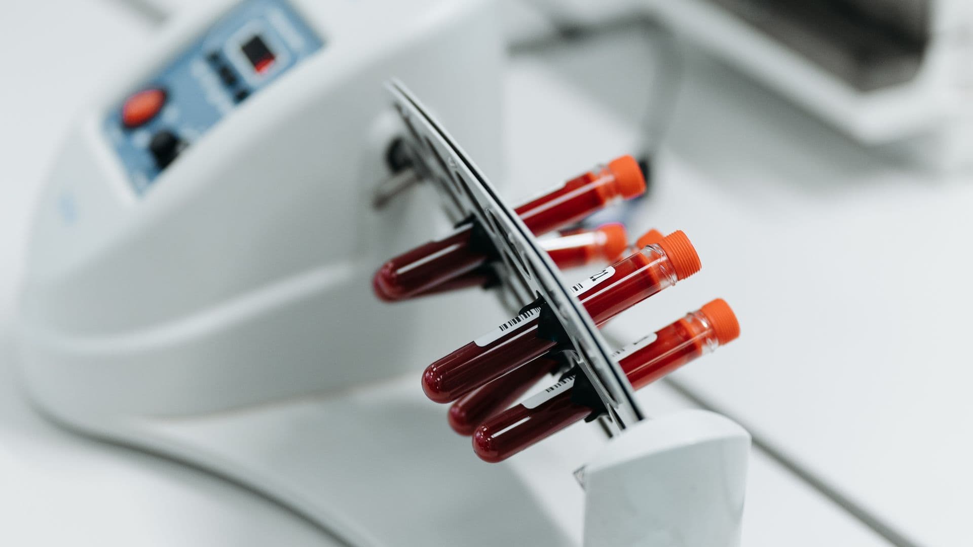 Blood sample analysis lab